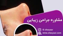 ویدیو و نمونه کار جراحی های زیبایی بینی
